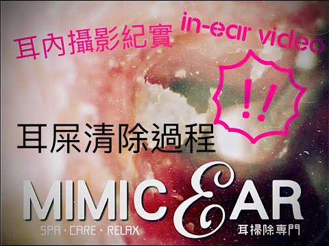 YT封面圖mimic